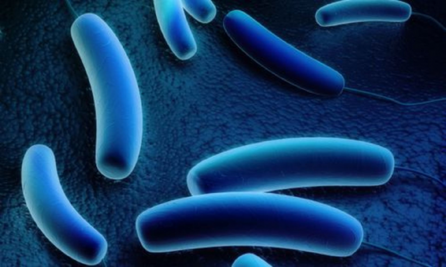 Lejyonella (Legionella) Analizi